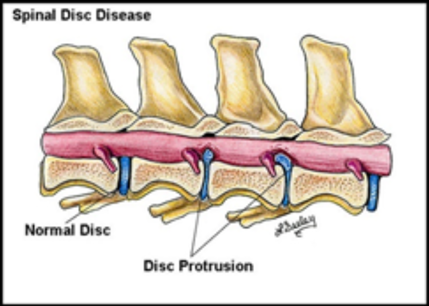spinal_2