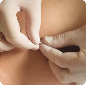 no-stitch_solution_for_surface_lumps